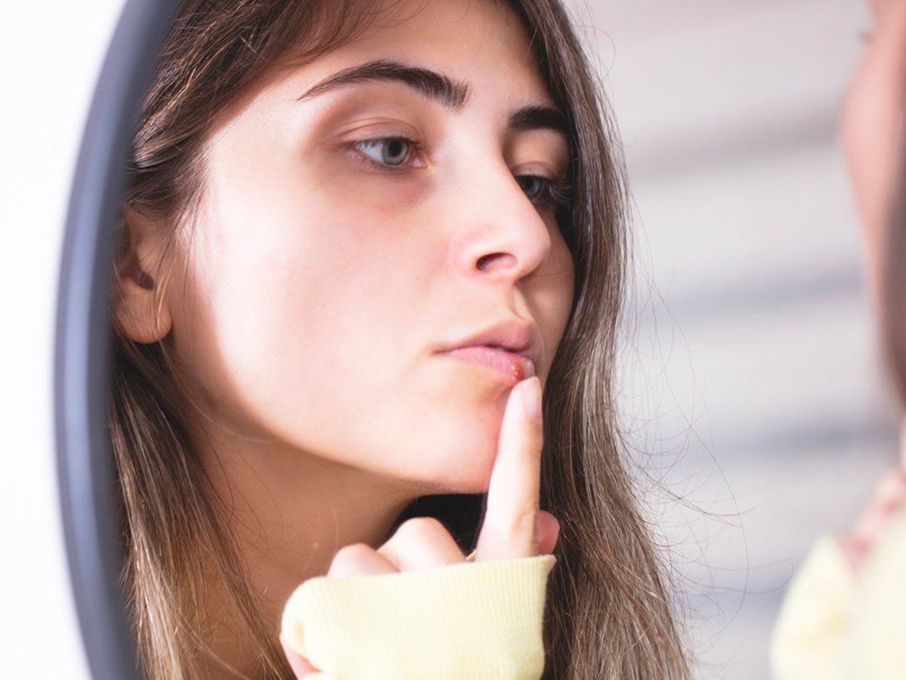 A young woman looking in the mirror and touching a cold sore on her lip